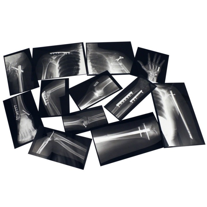 Roylco® Fixed Bones X-Ray Set