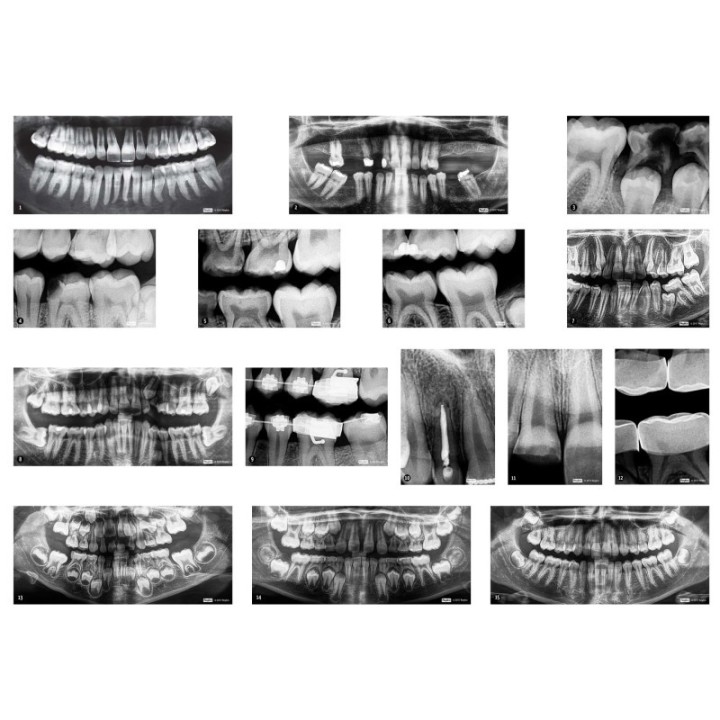 Roylco® Dental X-Rays
